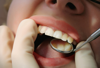 歯科健診でのインプラントチェック