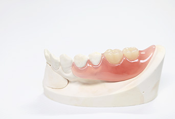 入れ歯（ノンクラスプデンチャー）